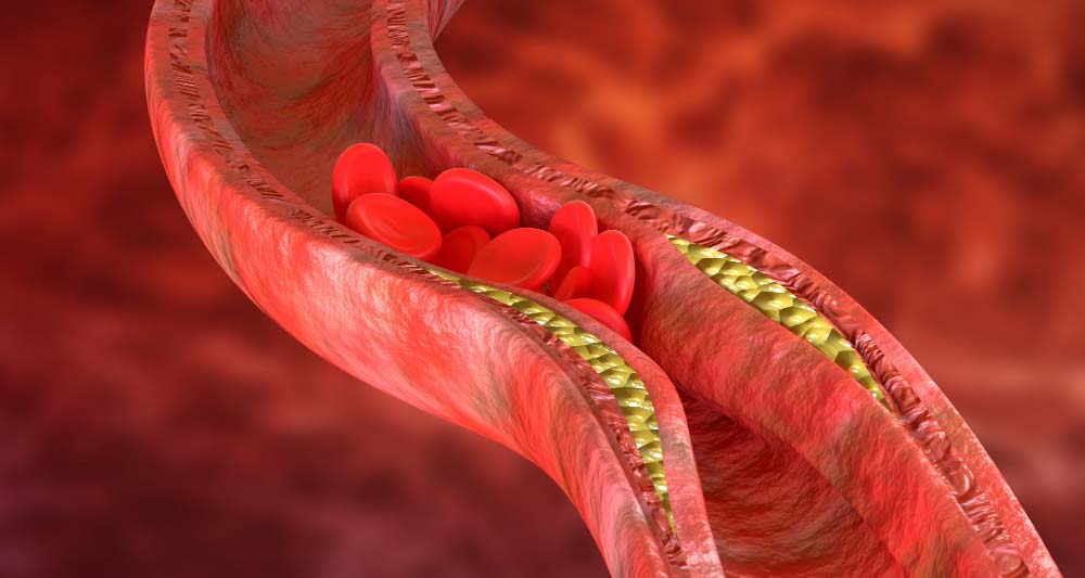 BUKVALNO HRANE KRV: Nema dobre KRVNE SLIKE bez ova TRI VITAMINA, a evo u kojim namirnicama ih ima najviše